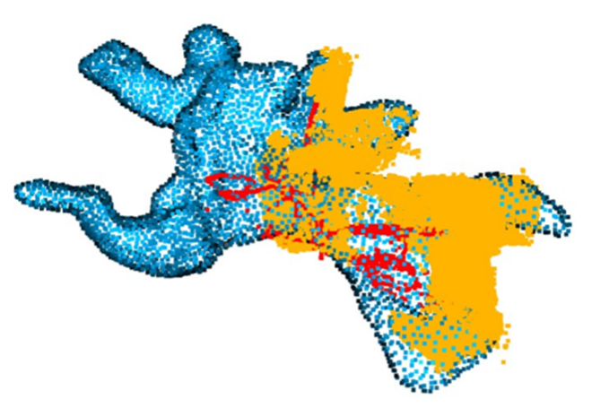 kidney_reconstruction